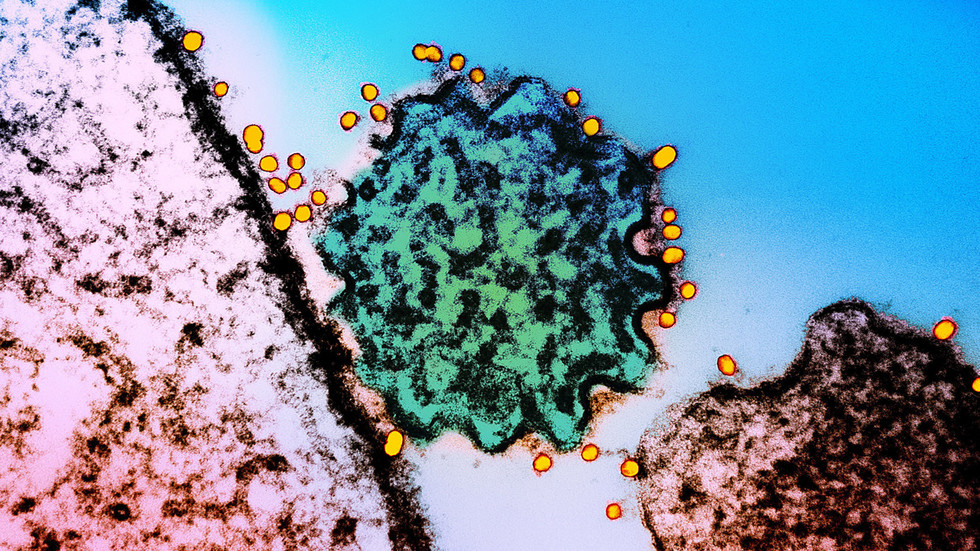 Indian virus scare: Media hits panic button over Nipah outbreak