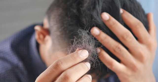 ‘Matter of Survival’: South Korean President Suggest Government Should Cover Hair Loss Treatment