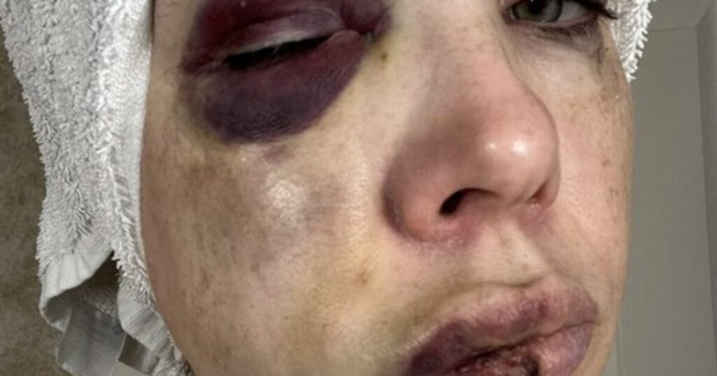 Senator Bernie Moreno Releases Horrific Photos of Cincinnati Mob Beating Victim
