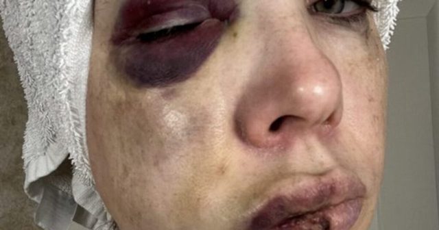 Senator Bernie Moreno Releases Horrific Photos of Cincinnati Mob Beating Victim