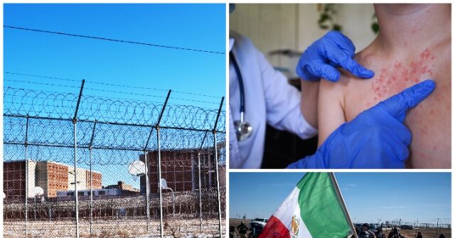 Texas ICE Facility Placed Under Quarantine After Measles Cases Confirmed Among Illegal Alien Detainees