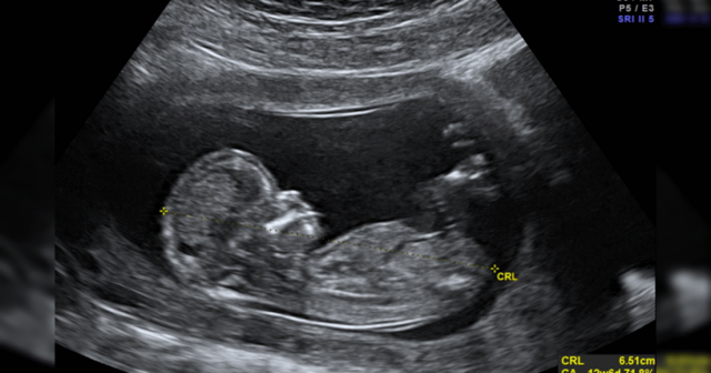 Texas Father Sues California Doctor for Wrongful Death of his Unborn Children in Landmark Abortion Pill Case