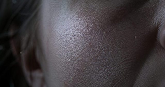 Crazy As It Sounds, There Are Probably Microscopic Mites In Your Face Pores That Come Out At Night