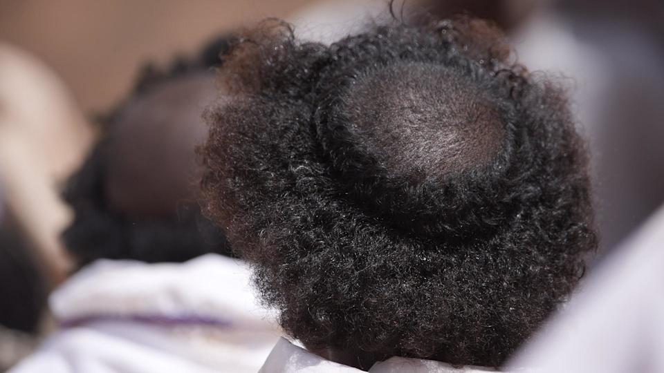 A circle is shaved into the back of a young man's hair.