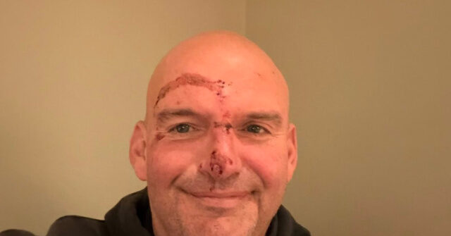 John Fetterman Makes ‘Full Recovery’ After Sustaining Injuries from Fall